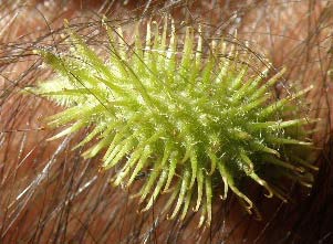 Cadillo enredeado en los pelos de mi brazo (Xanthium strumarium)