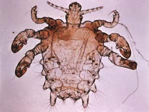 Piojo del pubis